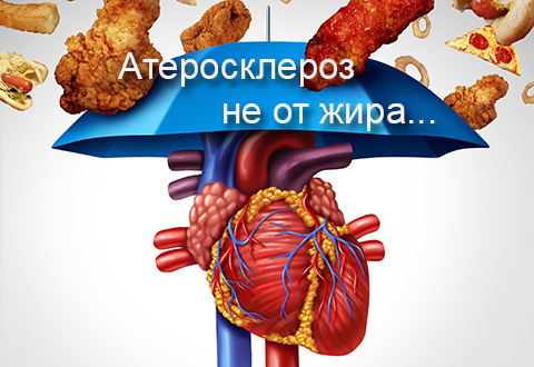 Атеросклероз не от жира, а…от неправильного образа жизни!