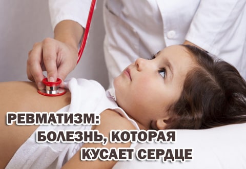 Ревматизм у детей — болезнь, которая кусает сердце