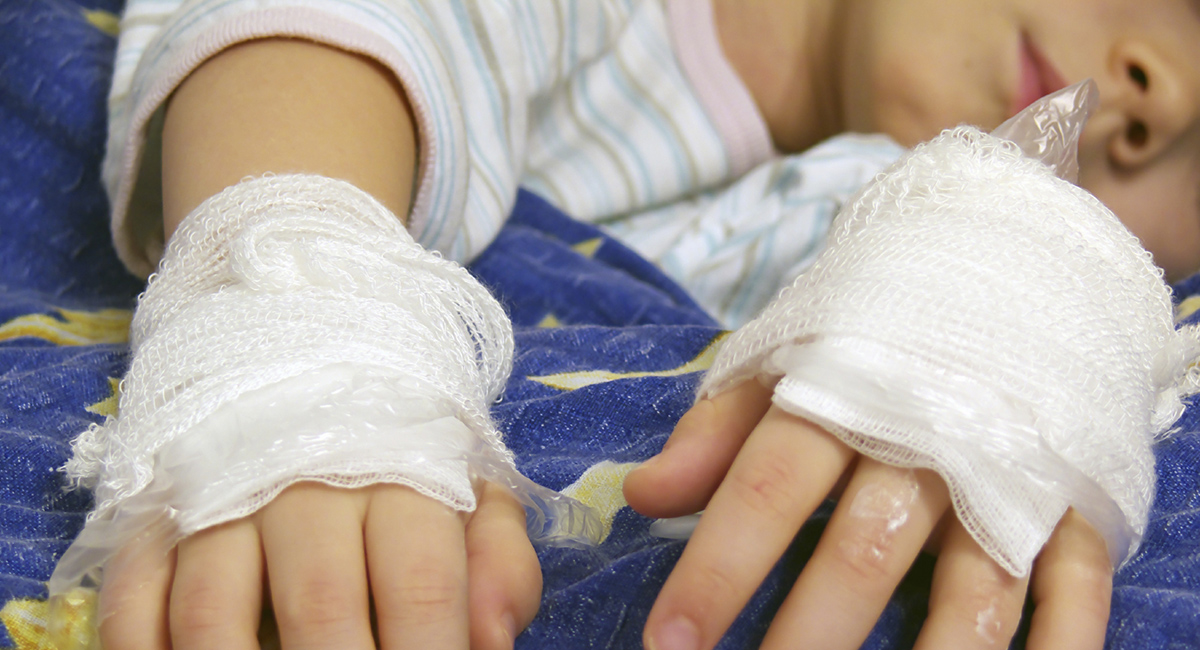 если ребенок обжегся или получил удар током если ребенок обжегся или получил удар током