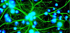 «Нервные клетки можно восстановить!», — с таким сенсационным заявлением выступили немецкие ученые. Именно им удалось преобразовать астроциты (клетки мозга, не выполняющие функцию нервных) в недостающие мозгу нейроны.