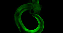Кишечные черви влияют на организм с помощью бактерий
