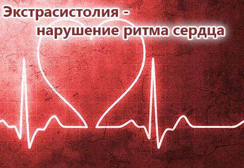 Экстрасистолия - нарушение ритма сердца