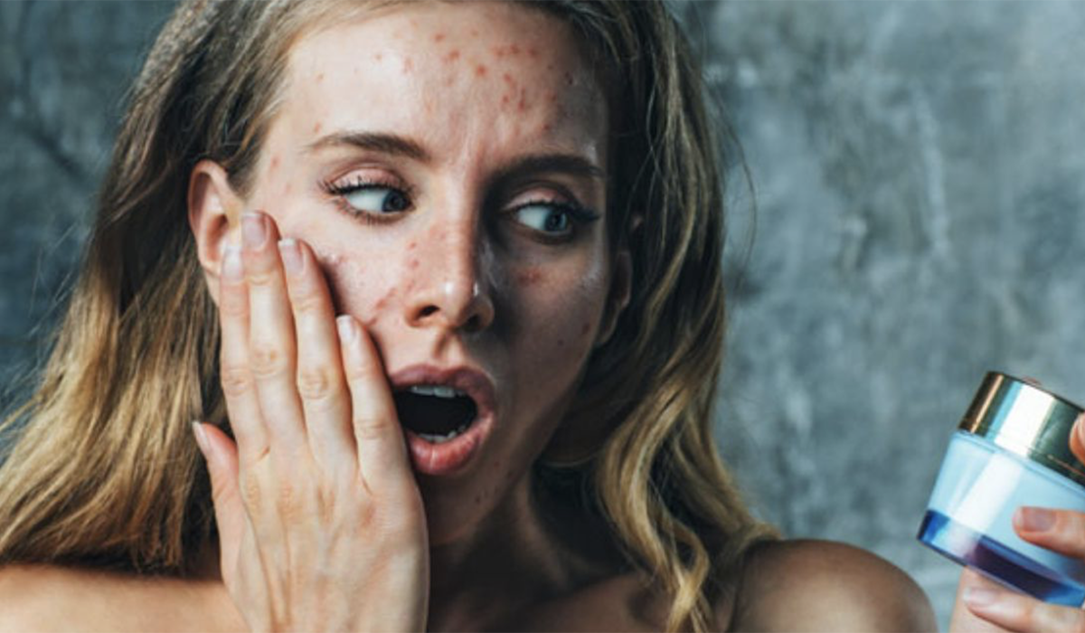 аллергия на косметику для лица