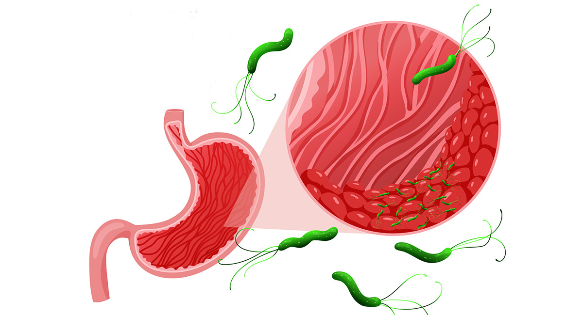 хеликобактер пилори