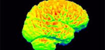 Ученые разработали новый способ восстановления мозга после инсульта