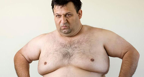 Ожирение мужчин по женскому типу