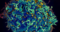 Тренировка антител для борьбы с вирусом ВИЧ