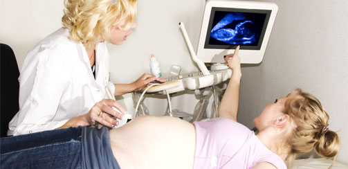 врачи во время беременности, узи