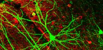 Ученые будут восстанавливать нервные клетки