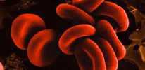 Американские ученые предупреждают: обладателям разных групп крови следует опасаться различных заболеваний.