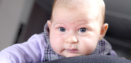Младенческая фаза атопического дерматита наблюдается у малыша с рождения до двух лет. Для этой формы атопии характерны сыпь на лице и разгибательных поверхностях рук и ног.