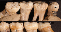 Доисторическая стоматология
