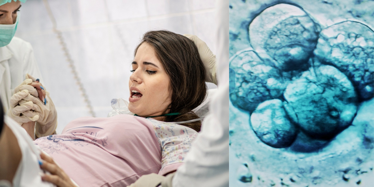 ЭКО оплодотворение, под микроскопом