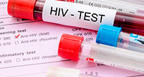 Принудительного учета людей с ВИЧ и СПИД не будет