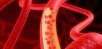 Ученые создали новую технологию восстановления кровеносных сосудов