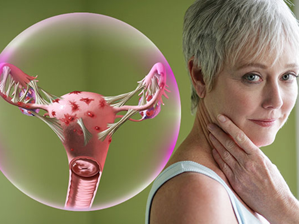 Симптомы менопаузы после 40. Заболевания в климактерическом периоде. Климакс. Климакс гинекология. Женщина после климакса.