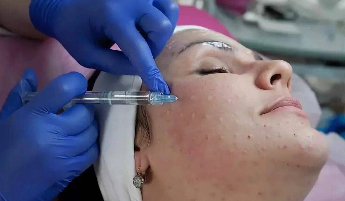 плазмолифтинг