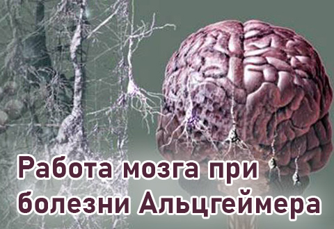 Работа мозга при болезни Альцгеймера