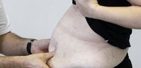 Каждый третий житель Земли страдает ожирением