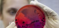 75 американских ученых заразились сибирской язвой