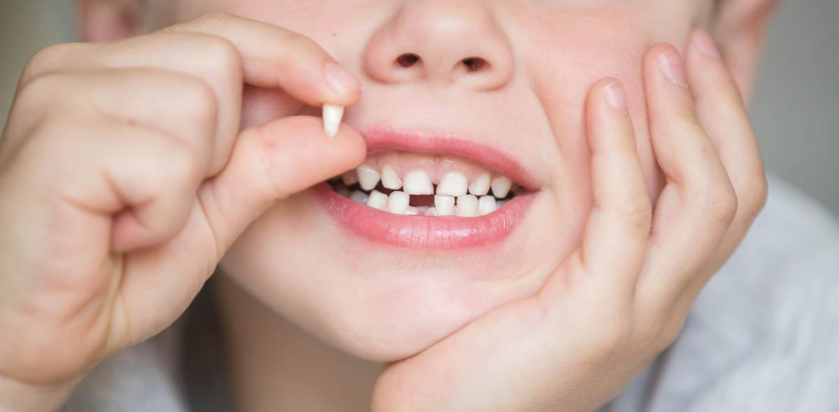 Травма зубов у детей, стоматология Травма зубов у детей, стоматология