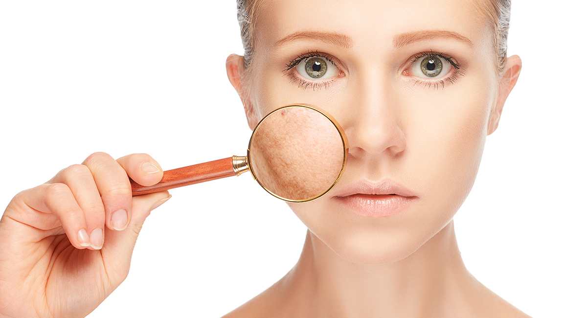 Гиперпигментация кожи Гиперпигментация кожи